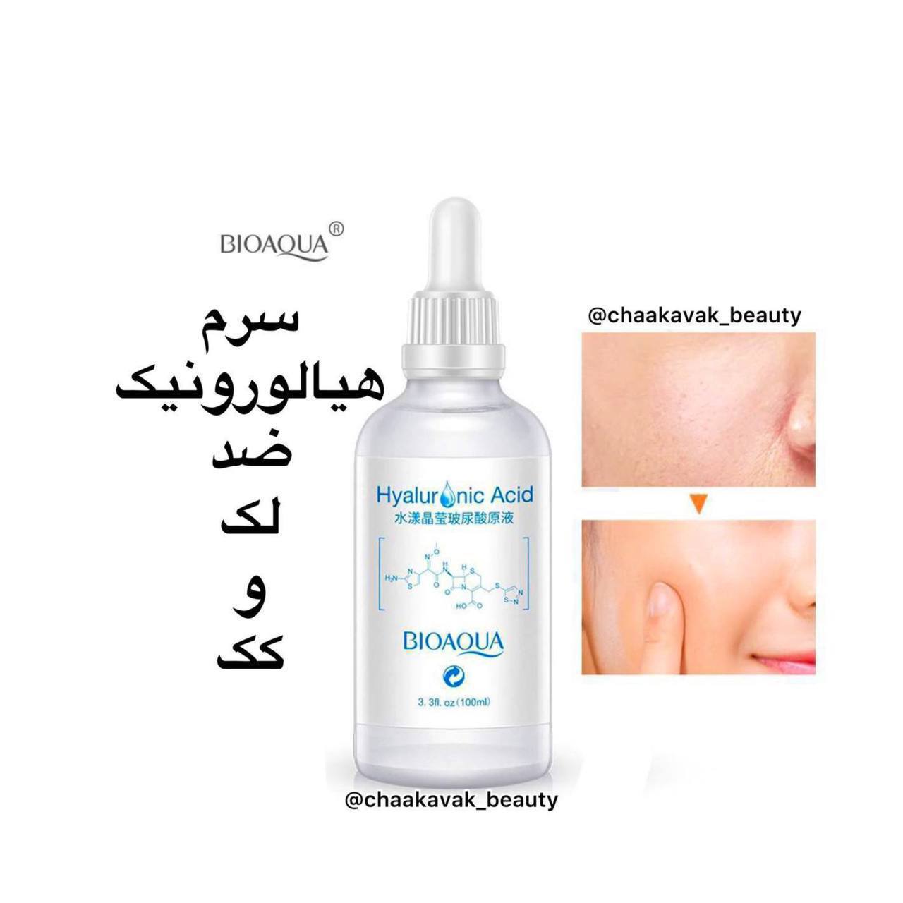 سرم هیالورونیک اسید بیوآکوا